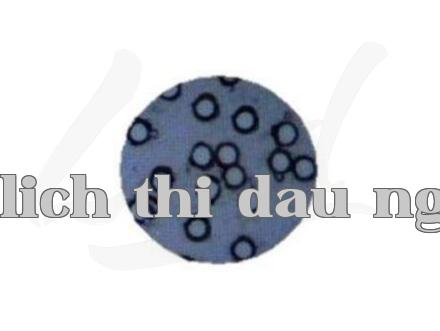 Giới thiệu công nghệ mới về xét nghiệm tế bào ung thư bàng quang
